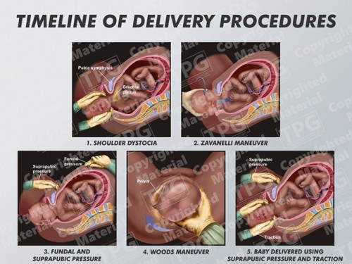 delivery-procedures-timeline