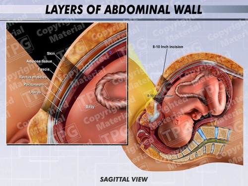 layers-of-abdominal-wall