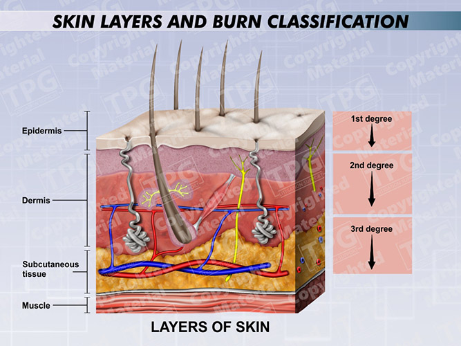 skin-layers-and-burn-classification