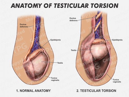 testicular-torsion-anatomy