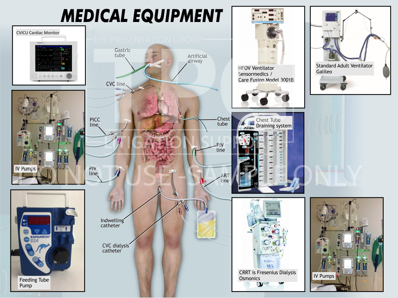 Medical Equipment/Medical Illustration - Presentation Group